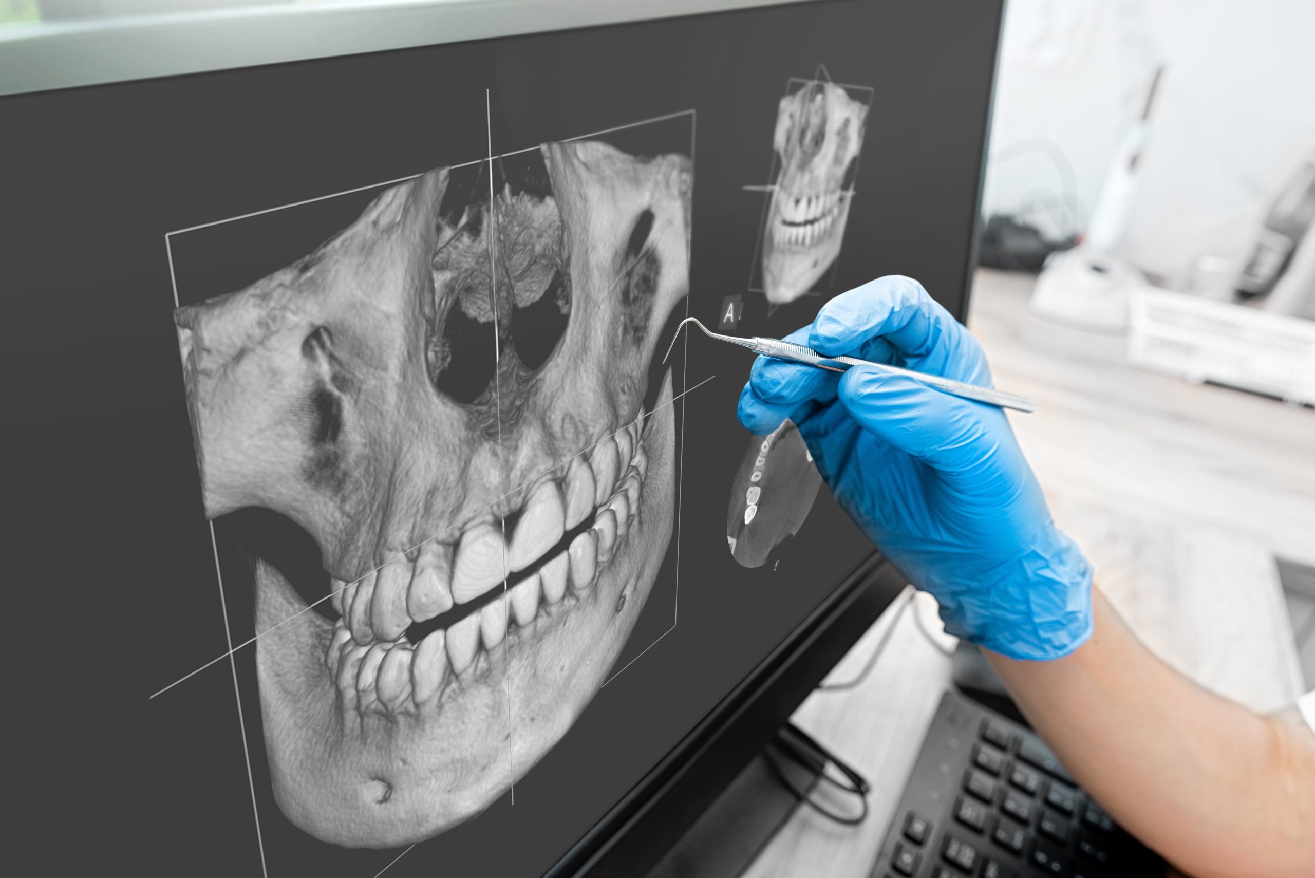 Carestream Dental Imaging Software for better treatment